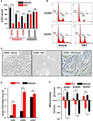 Glucocorticoid mediated inhibition of LKB1 mutant non-small cell lung cancers